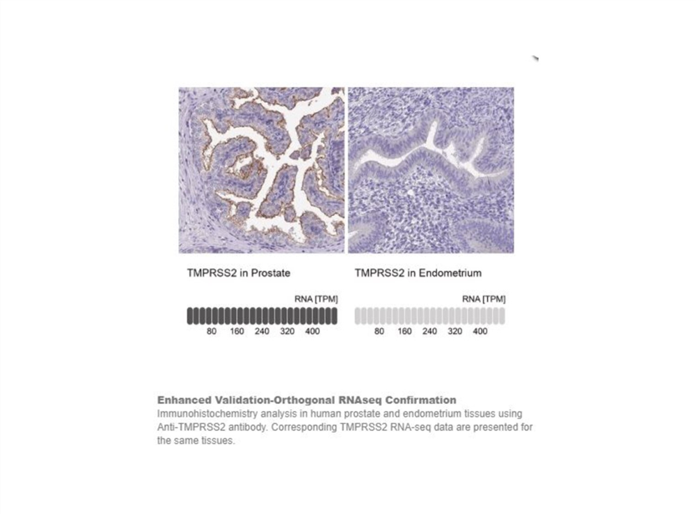 Picture of Anti-TMPRSS2 antibody produced in rabbit